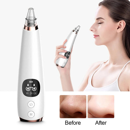 Rechargeable Facial Pore Cleanser