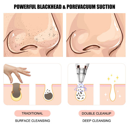 Rechargeable Facial Pore Cleanser